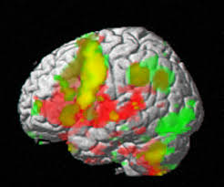 neuromatriz del dolor